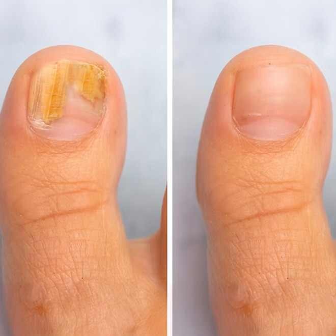 WellNail image